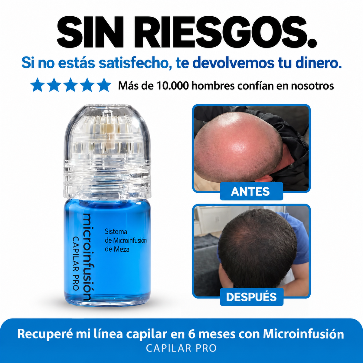 Microinfusión Capilar Pro – Tratamiento Avanzado para el Cabello
