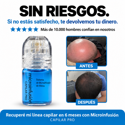 Microinfusión Capilar Pro – Tratamiento Avanzado para el Cabello